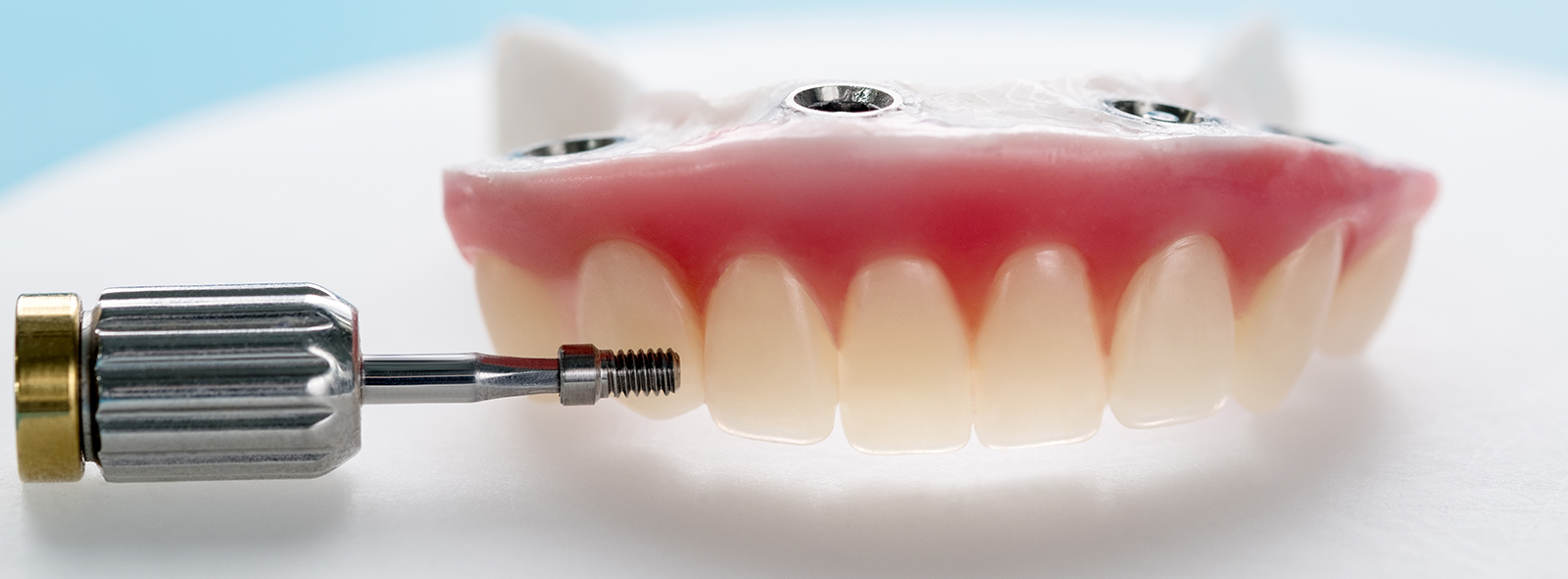 All-On-Four Fixed Implant Teeth